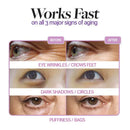 Freezeframe Revitaleyes 15ml